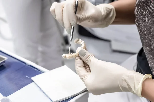 El dentista aplica la solución a una prótesis temporal artificial en el consultorio del dentista, un primer plano de las manos con la prótesis — Foto de Stock