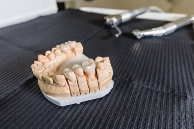 Diş kaplaması ve kaplamalı yapay çiğneme diş laboratuarındaki masanın üzerinde duruyor. Teknik ve profesyonel ekipmanlar