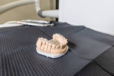 Diş kaplaması ve kaplamalı yapay çiğneme diş laboratuarındaki masanın üzerinde duruyor. Teknik ve profesyonel ekipmanlar