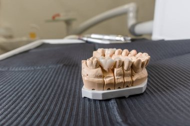 Diş kaplaması ve kaplamalı yapay çiğneme diş laboratuarındaki masanın üzerinde duruyor. Teknik ve profesyonel ekipmanlar