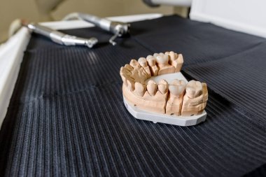 Diş kaplaması ve kaplamalı yapay çiğneme diş laboratuarındaki masanın üzerinde duruyor. Teknik ve profesyonel ekipmanlar