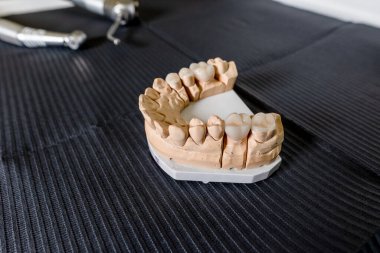 Diş kaplaması ve kaplamalı yapay çiğneme diş laboratuarındaki masanın üzerinde duruyor. Teknik ve profesyonel ekipmanlar