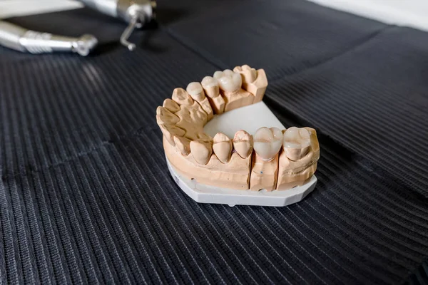 Masticar artificial con coronas y carillas de dientes hechas está de pie sobre la mesa en el laboratorio dental. Equipos técnicos y profesionales —  Fotos de Stock