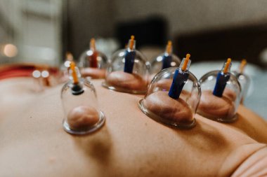 Ev tedavisi için kap terapisi. 