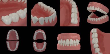 siyah arka plan üzerinde 3D render diş