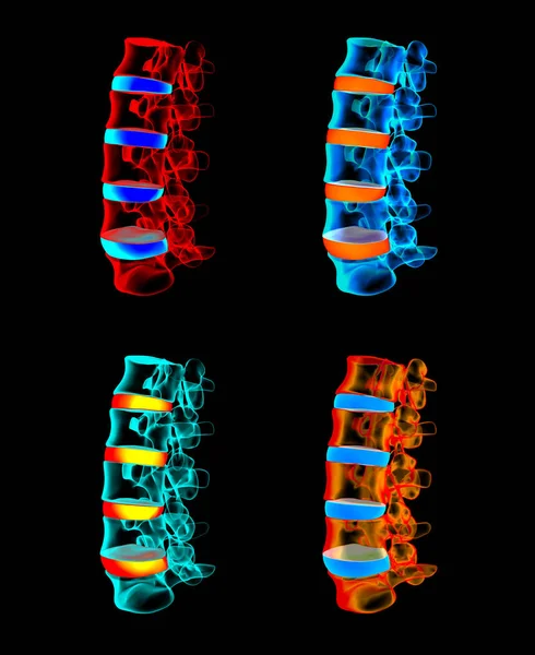3D vykreslení - struktura páteře na černém pozadí s modrým rotace — Stock fotografie