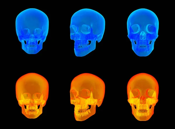 3d renderização do crânio de raios X humano — Fotografia de Stock