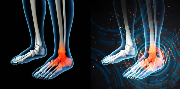 3d 渲染人类足部疼痛与骨架的脚的解剖 — 图库照片#
