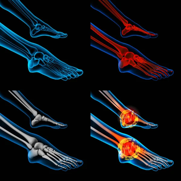 3D tornando a dor no pé humano com a anatomia de um pé de esqueleto — Fotografia de Stock