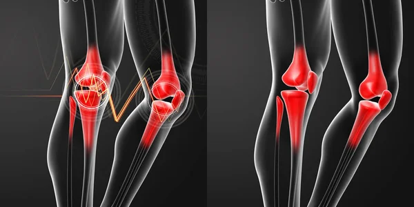 3D rendering human knee pain with the anatomy of a skeleton leg