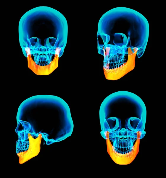 3D renderowania ilustracja kości szczęki — Zdjęcie stockowe