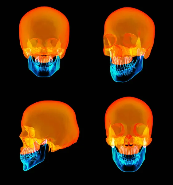 Representación 3D del cráneo humano Mitad superior — Foto de Stock