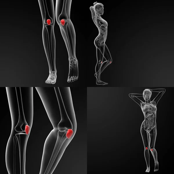 3D rendering illustration av knäskålen ben — Stockfoto