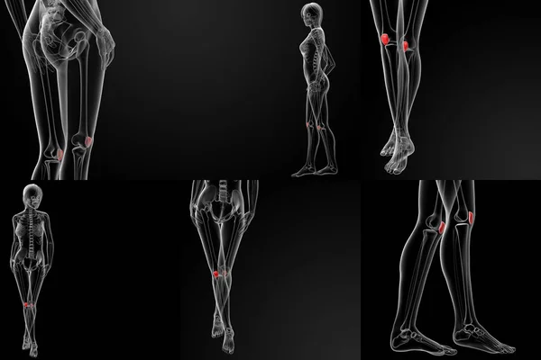 膝蓋骨の骨の 3 d レンダリング図 — ストック写真