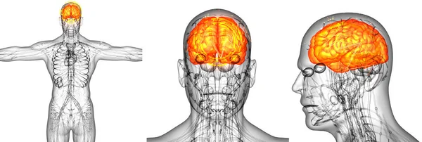 3d hacer ilustración médica del dolor cerebral humano — Foto de Stock