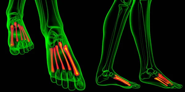 3d rendering medical illustration of the metatarsal bones — Stock Photo, Image