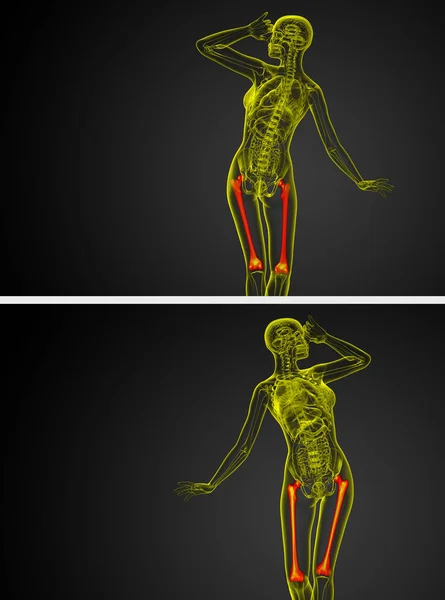 3D vykreslování lékařské ilustrace stehenní kosti — Stock fotografie