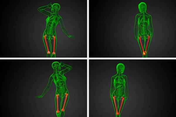 3D rendering medicinsk illustration av lårbenet ben — Stockfoto
