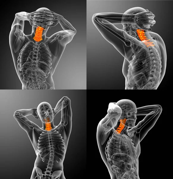3D vykreslování lékařské ilustrace krční páteře — Stock fotografie
