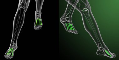 3D render Medikal illüstrasyon metatarsal kemik 