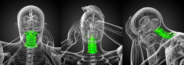 3D rendering medicinsk illustration av halsryggen — Stockfoto