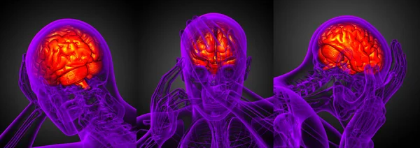 Illustration médicale du cerveau en 3D — Photo