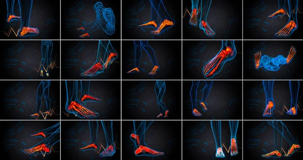 3D-Darstellung medizinischer Darstellung des Fußknochens — Stockfoto