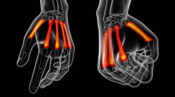 3D-Darstellung medizinischer Darstellung des Mittelhandknochens — Stockfoto
