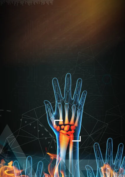 3d renderizado anatomía ilustración - dolor de manos — Foto de Stock