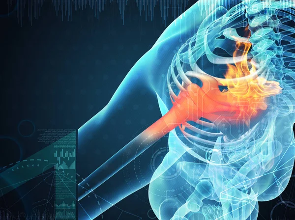 3d 呈现人类肩痛与骨骼的解剖 — 图库照片#
