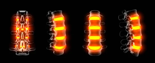 Rendering 3d della struttura della colonna vertebrale su sfondo nero — Foto Stock