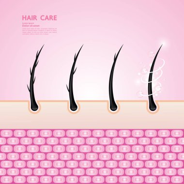 Hair problem and hair protect and care technology concept vector illustration.