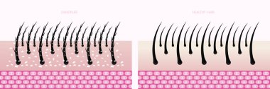 Hair problem and hair protect and care technology concept vector illustration.
