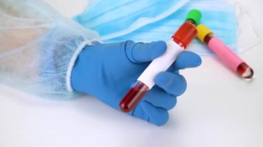 Vakum tüpünde kan örneği tutuyor. Yeni hızla yayılan Coronavirüs için pozitif test sonuçları