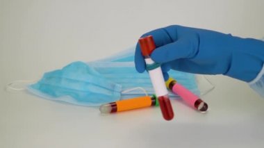 Hand holding blood sample in vacuum tube. Positive test result for the rapidly spreading Coronavirus, originating in Wuhan, China. New type virus 2019-n CoV. MERS chinese infection, atypical pneumonia