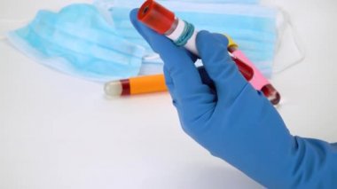 Hand holding blood sample in vacuum tube. Positive test result for the rapidly spreading Coronavirus, originating in Wuhan, China. New type virus 2019-n CoV. MERS chinese infection, atypical pneumonia