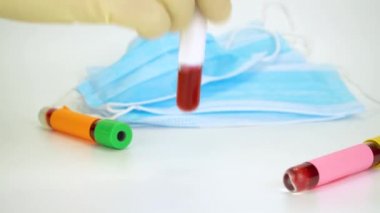Hand holding blood sample in vacuum tube. Positive test result for the rapidly spreading Coronavirus, originating in Wuhan, China. New type virus 2019-n CoV. MERS chinese infection, atypical pneumonia