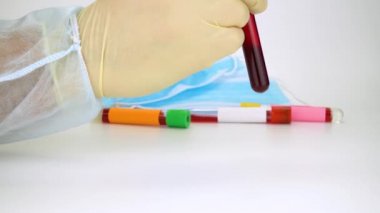 Hand holding blood sample in vacuum tube. Positive test result for the rapidly spreading Coronavirus, originating in Wuhan, China. New type virus 2019-n CoV. MERS chinese infection, atypical pneumonia
