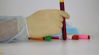 Hand holding blood sample in vacuum tube. Positive test result for the rapidly spreading Coronavirus, originating in Wuhan, China. New type virus 2019-n CoV. MERS chinese infection, atypical pneumonia