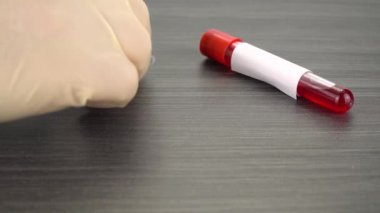 medical protective mask and blood test tube. Concept of coronavirus quarantine. New type virus 2019-nCoV pneumonia in Wuhan. Spread of a deadly infection around the world. MERS respiratory syndrome.