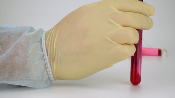 Рука держит образец крови в вакуумной трубке. Положительный результат теста нового быстро распространяющегося коронавируса — стоковое видео