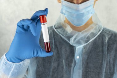 Ellerinde kan testi olan bir doktor. Koronavirüs karantinası kavramı. 