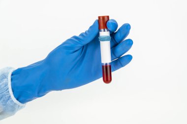 Vakum tüpünde kan örneği tutuyor. Yeni hızla yayılan Coronavirüs için pozitif test sonuçları
