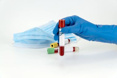 Vakum tüpünde kan örneği tutuyor. Yeni hızla yayılan Coronavirüs için pozitif test sonuçları