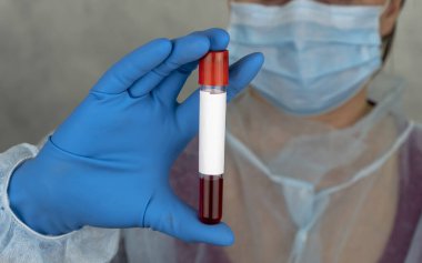 Koronavirüsü önleme ve tedavi etme. Ellerinde kan testi olan bir doktor. Koronavirüs karantinası kavramı.