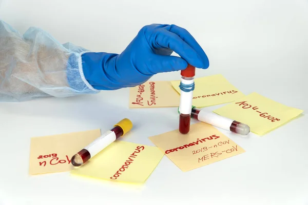 Zapobieganie i leczenie koronawirusów. Ręczne trzymanie próbki krwi w probówce próżniowej. — Zdjęcie stockowe