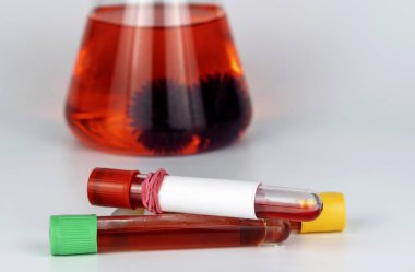 Coronavirus COVID-19 için laboratuvar kan örnekleri test ediyor. Virüs molekülleri ile kimyasal matara