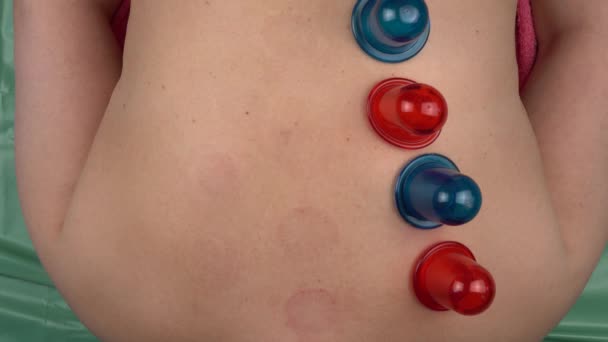 Blaue Und Rote Cellulite Vakuum Silikonbanken Für Den Körper Werkzeug — Stockvideo