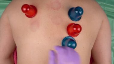 Elinde anti-selülit vakum silikon vücut kavanozları tutan tıbbi eldiven var. Selülit, soğuk algınlığı ve omurga ağrısına karşı mücadele için masaj ve sağlık prosedürleri. Kavanoz kan dolaşımını hızlandırır