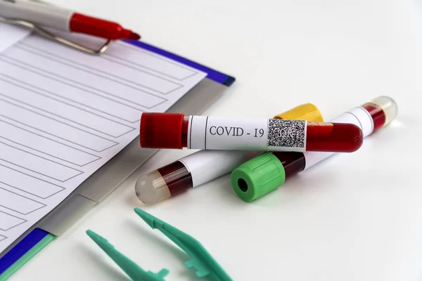 Est Dla Koronawirusa Kolba Medyczna Badaniem Krwi Obecność Wirusa Covid — Zdjęcie stockowe